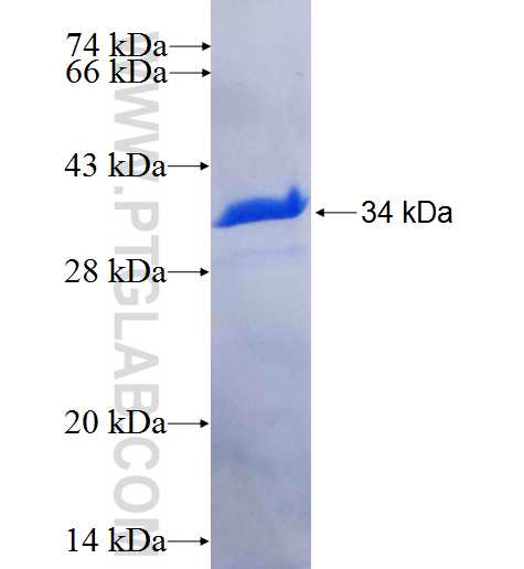 AP1M1 fusion protein Ag25303 SDS-PAGE