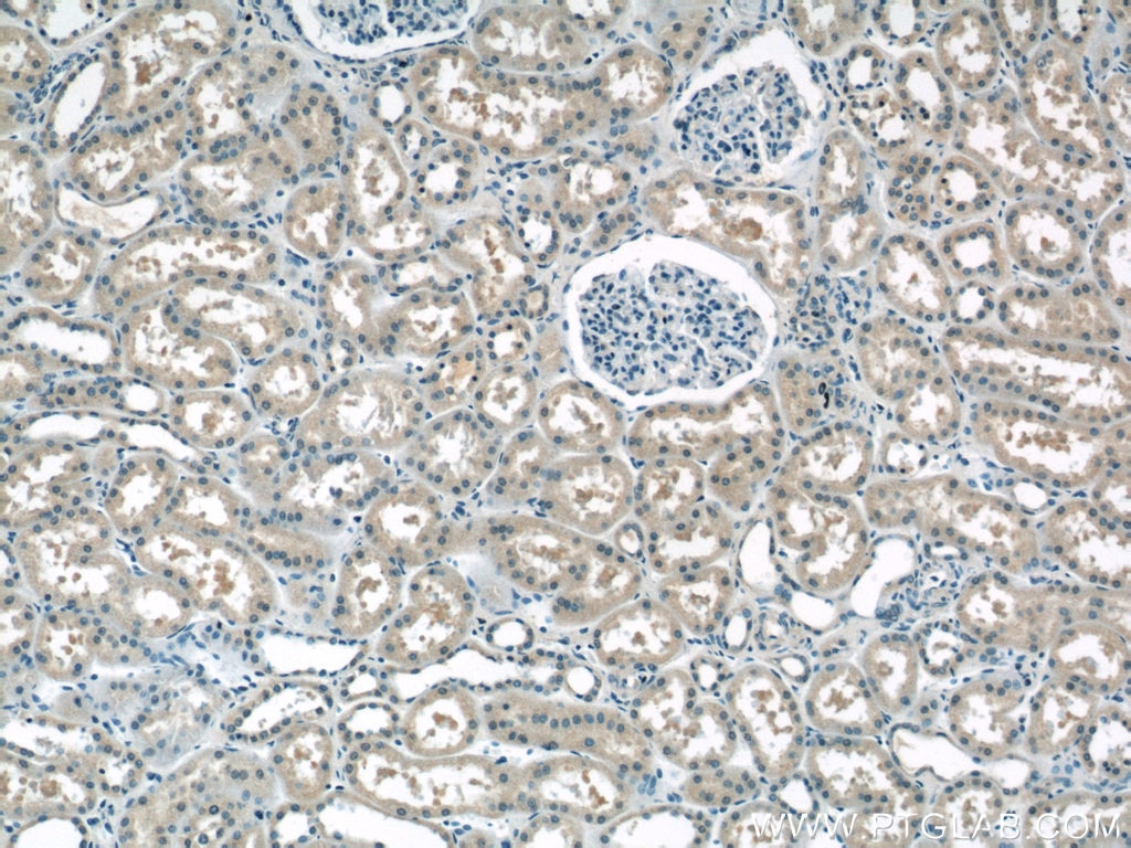 Immunohistochemistry (IHC) staining of human kidney tissue using AP1M2 Polyclonal antibody (10618-1-AP)
