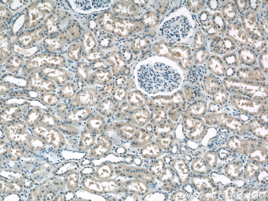 IHC staining of human kidney using 10618-1-AP