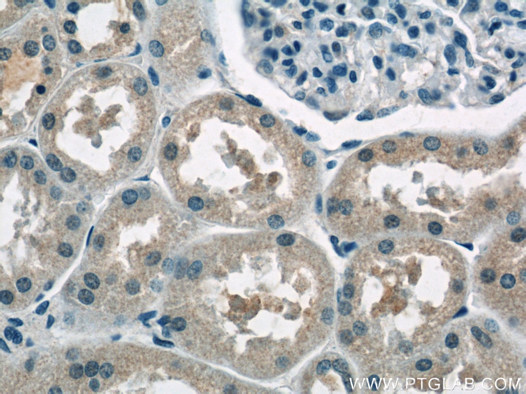 Immunohistochemistry (IHC) staining of human kidney tissue using AP1M2 Polyclonal antibody (10618-1-AP)