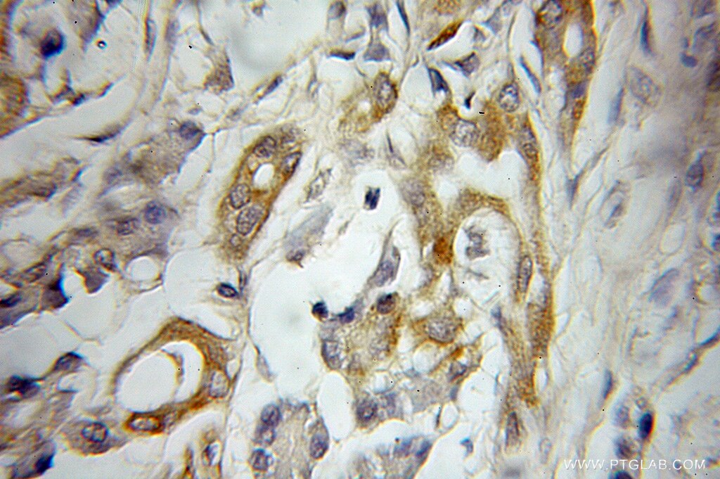 AP1M2 Polyclonal antibody