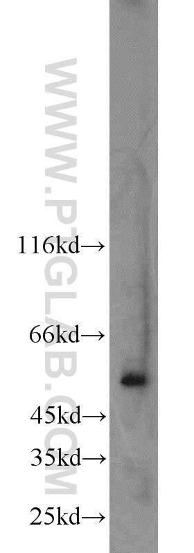 Western Blot (WB) analysis of BxPC-3 cells using AP1M2 Polyclonal antibody (10618-1-AP)