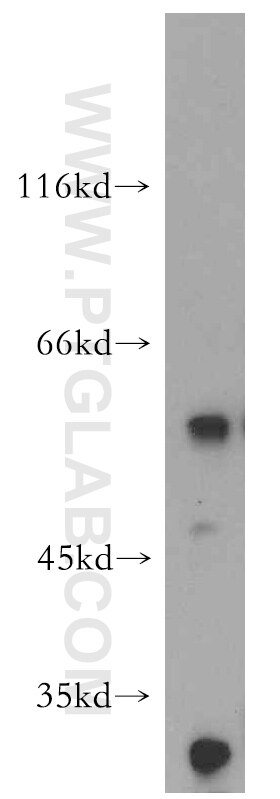 Western Blot (WB) analysis of mouse colon tissue using AP1M2 Polyclonal antibody (10618-1-AP)