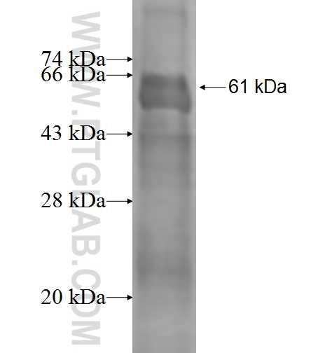 AP1M2 fusion protein Ag0961 SDS-PAGE