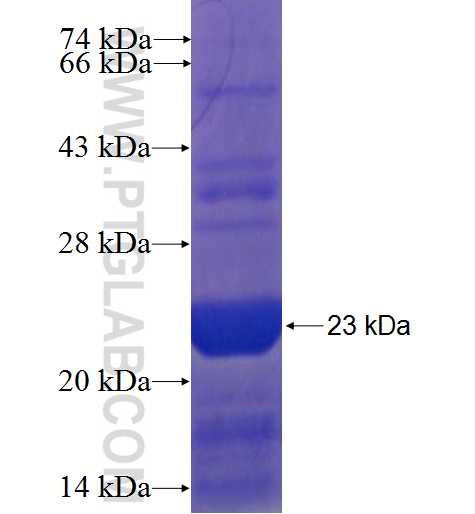 AP1S2 fusion protein Ag6752 SDS-PAGE