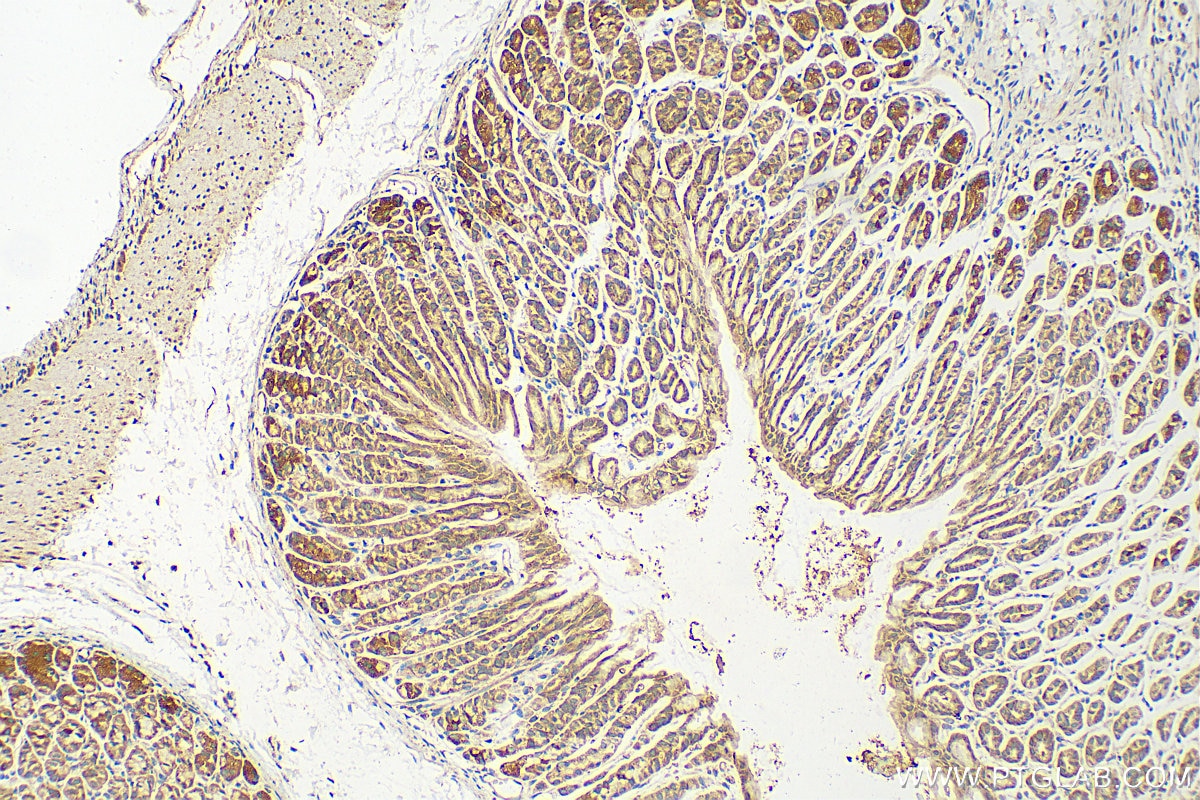 Immunohistochemistry (IHC) staining of mouse stomach tissue using AP1S3 Polyclonal antibody (17365-1-AP)