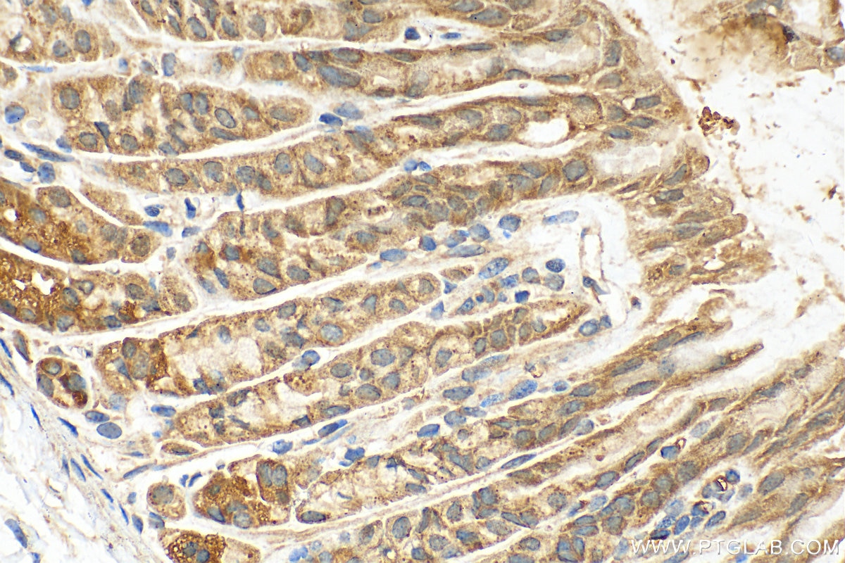 Immunohistochemistry (IHC) staining of mouse stomach tissue using AP1S3 Polyclonal antibody (17365-1-AP)