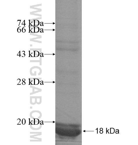 AP1S3 fusion protein Ag10751 SDS-PAGE