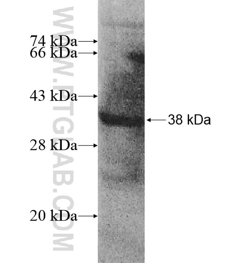 AP1S3 fusion protein Ag10777 SDS-PAGE