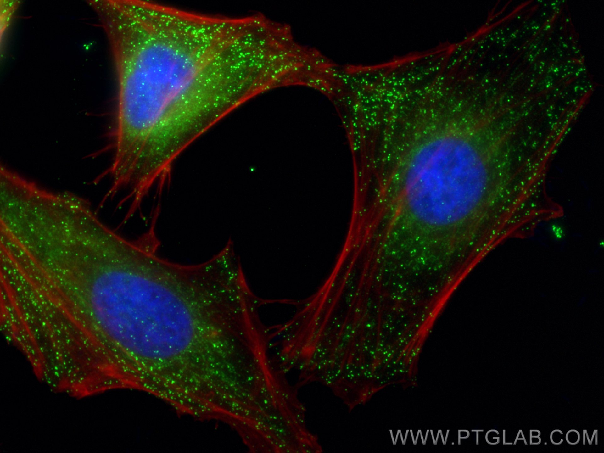 Immunofluorescence (IF) / fluorescent staining of HeLa cells using Alpha Adaptin Polyclonal antibody (11401-1-AP)