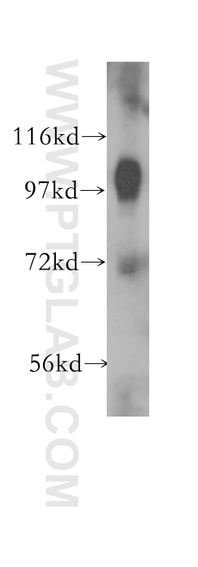Western Blot (WB) analysis of human heart tissue using Alpha Adaptin Polyclonal antibody (11401-1-AP)