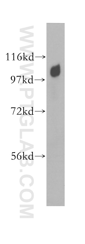 Western Blot (WB) analysis of HEK-293 cells using Alpha Adaptin Polyclonal antibody (11401-1-AP)