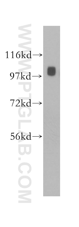 Western Blot (WB) analysis of human spleen tissue using Alpha Adaptin Polyclonal antibody (11401-1-AP)