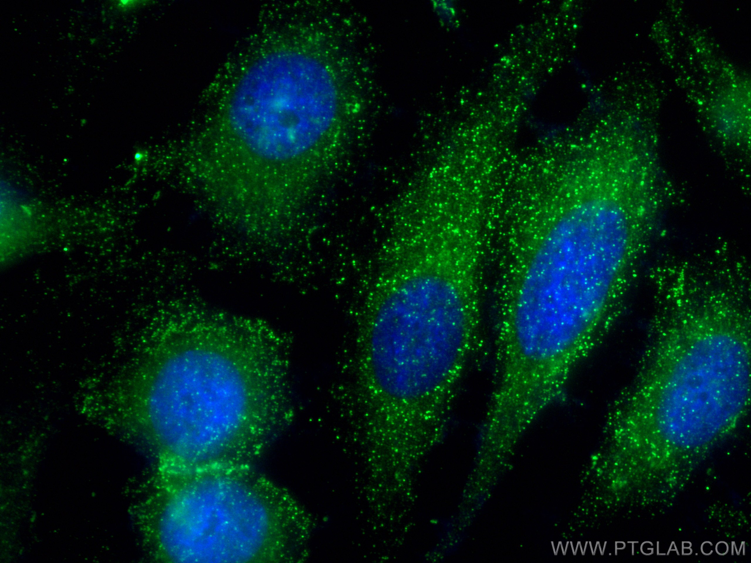 Immunofluorescence (IF) / fluorescent staining of HeLa cells using AP2A1 Polyclonal antibody (29887-1-AP)