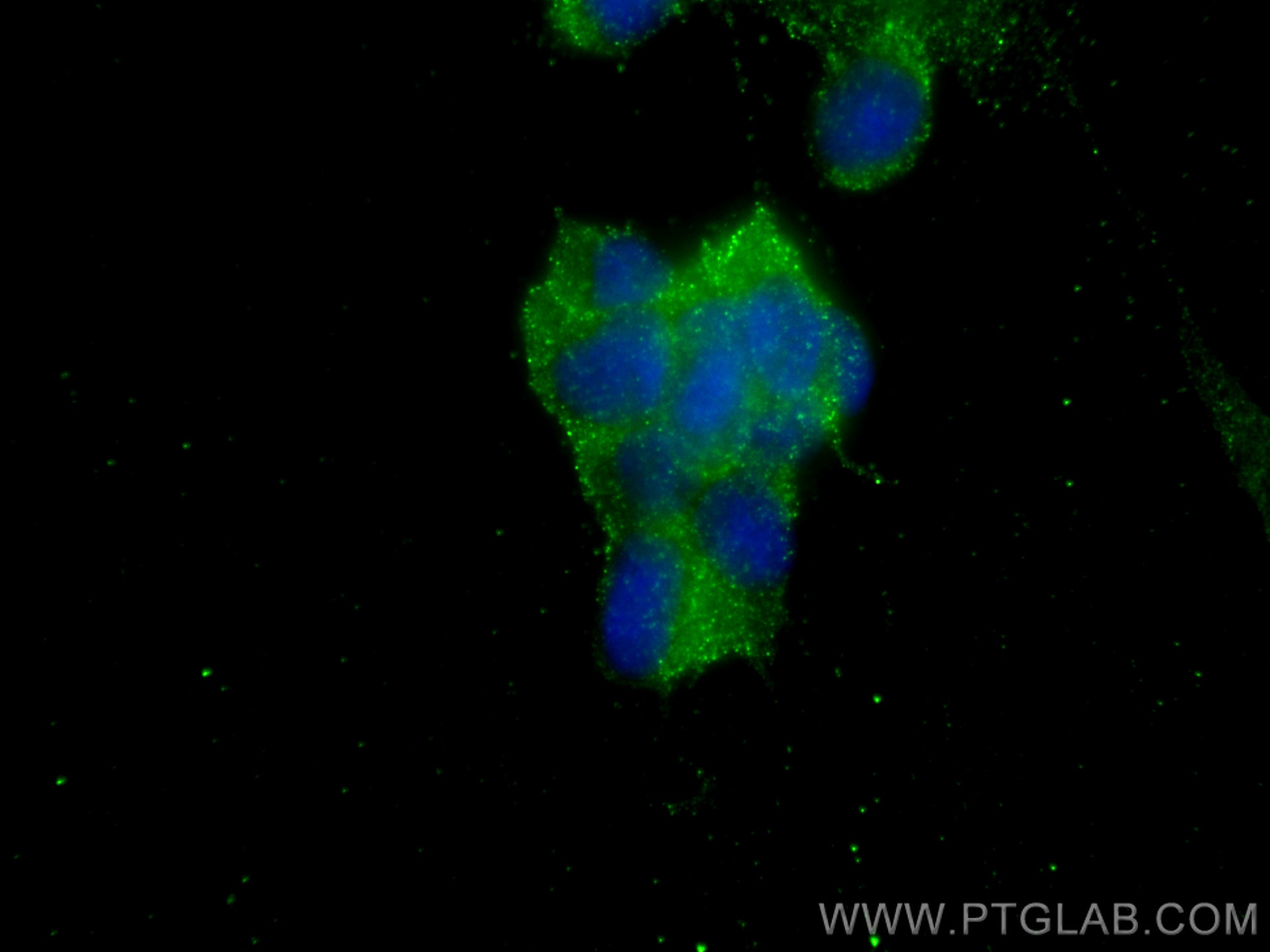 Immunofluorescence (IF) / fluorescent staining of SH-SY5Y cells using AP2A1 Polyclonal antibody (29887-1-AP)