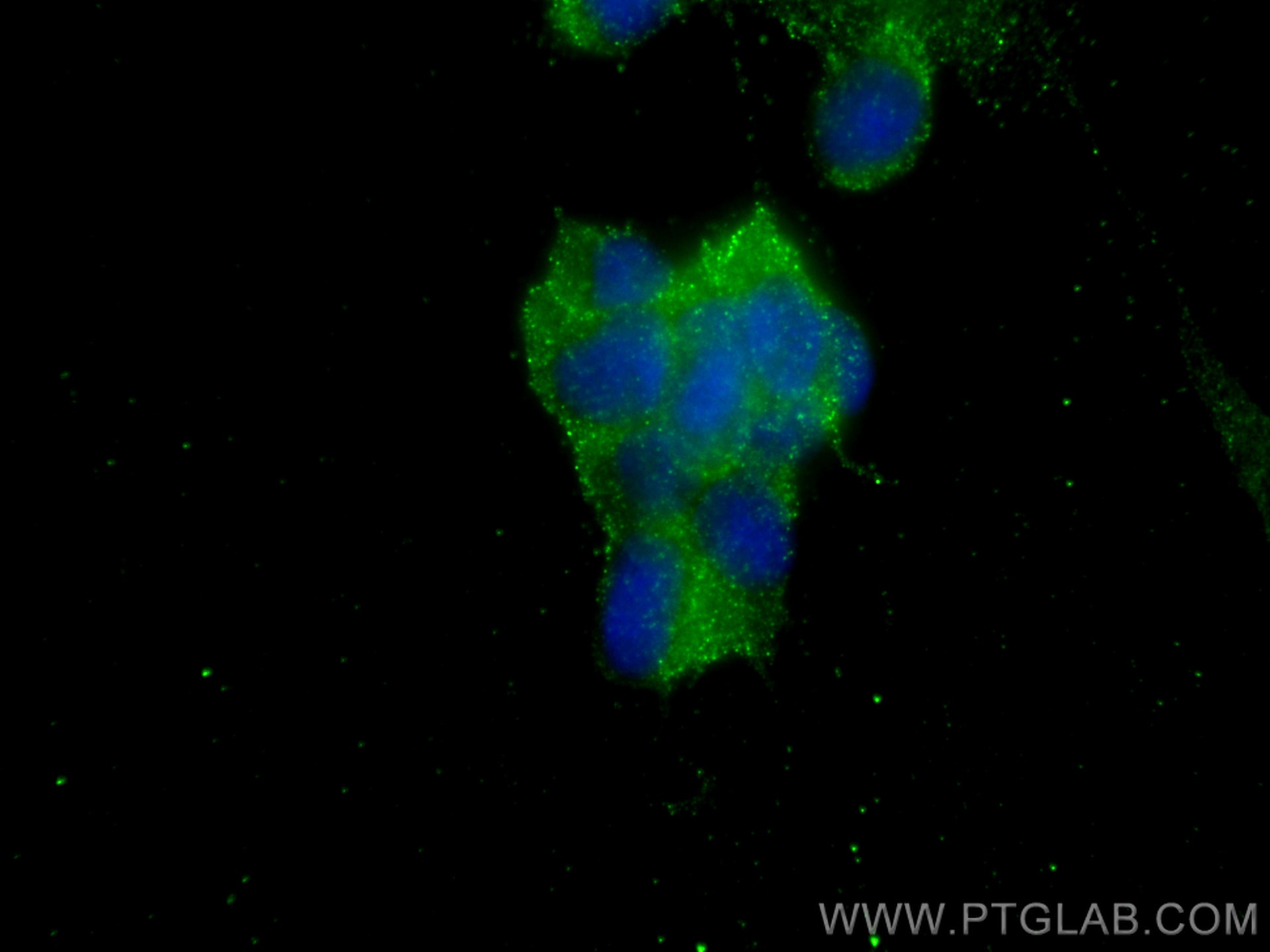 IF Staining of SH-SY5Y using 29887-1-AP