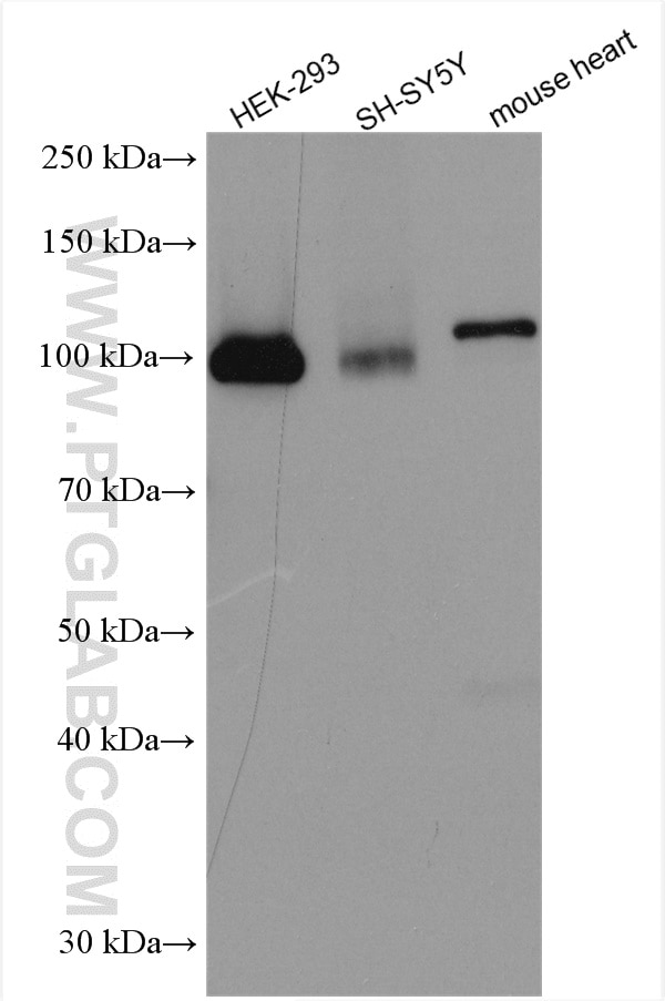 Western Blot (WB) analysis of various lysates using AP2A1 Polyclonal antibody (29887-1-AP)