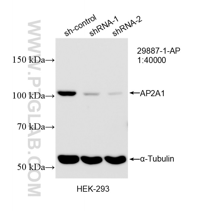 WB analysis of HEK-293 using 29887-1-AP Western Blot (WB) analysis of HEK-293 cells using AP2A1 Polyclonal antibody (29887-1-AP)