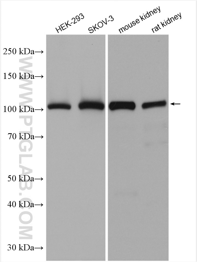 Western Blot (WB) analysis of various lysates using AP2A1 Polyclonal antibody (30030-1-AP)