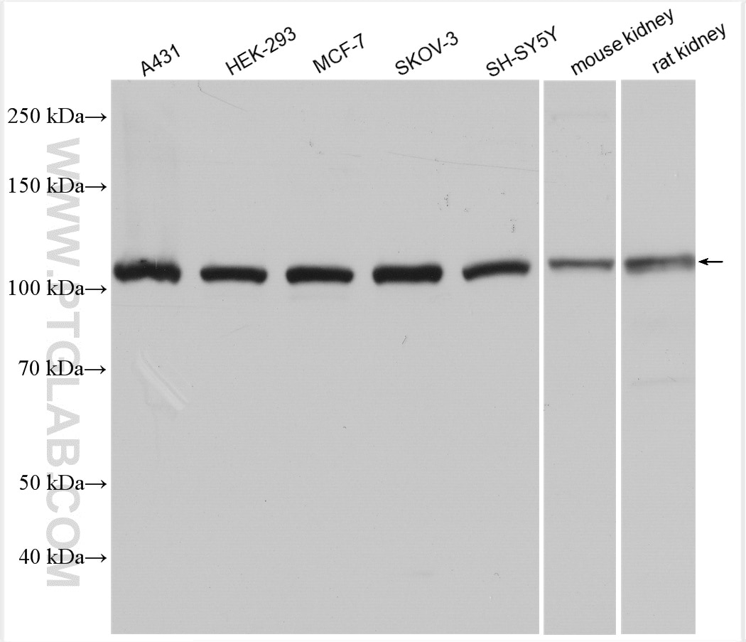 Western Blot (WB) analysis of various lysates using AP2A1 Polyclonal antibody (30030-1-AP)