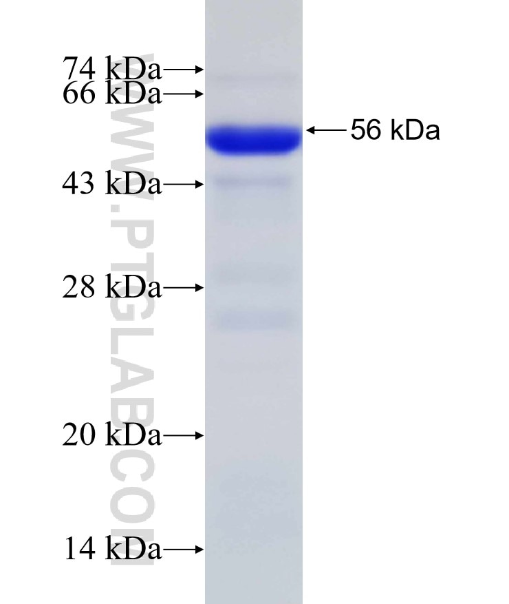 AP2A1 fusion protein Ag31809 SDS-PAGE