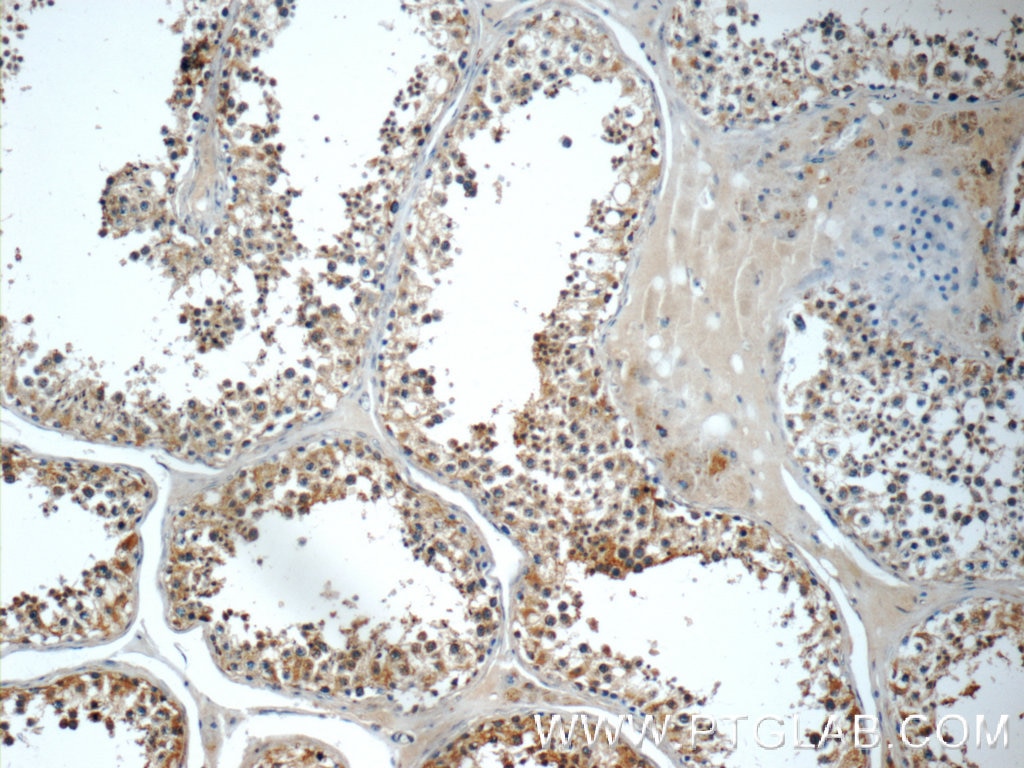 Immunohistochemistry (IHC) staining of human testis tissue using AP2A2 Polyclonal antibody (15722-1-AP)