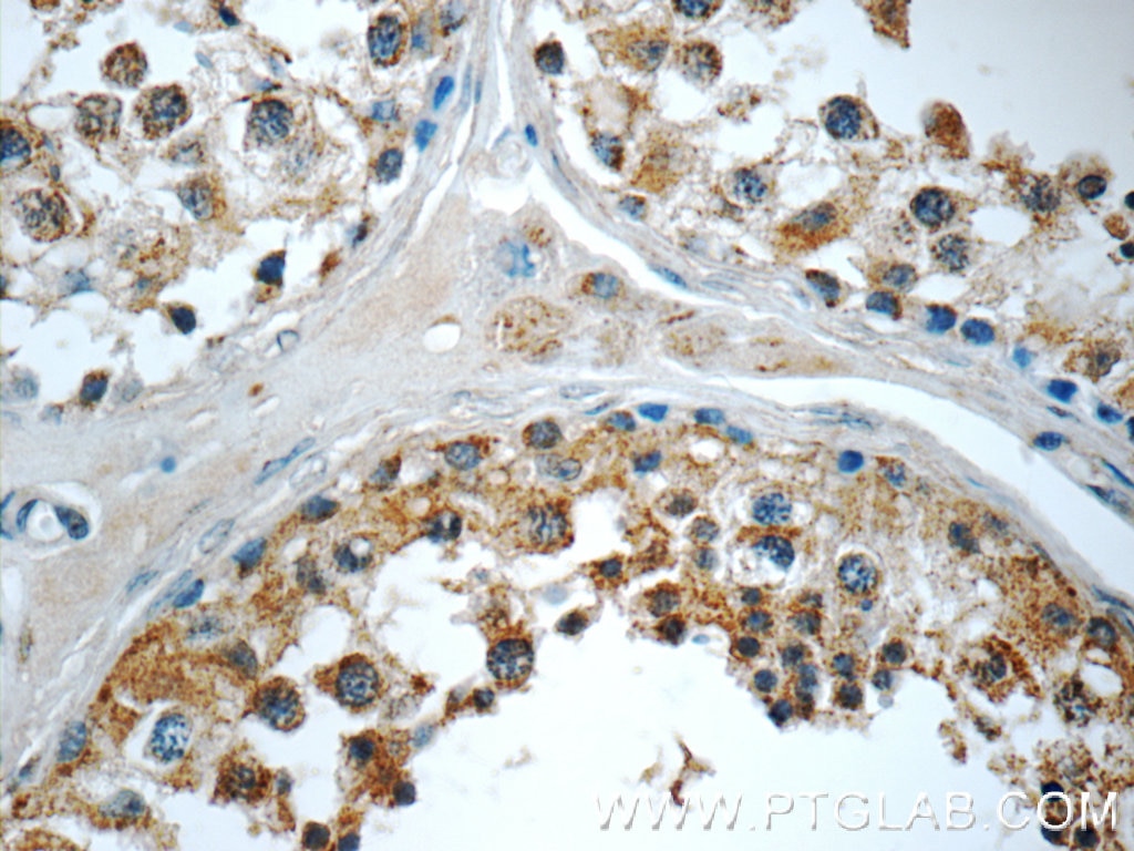 Immunohistochemistry (IHC) staining of human testis tissue using AP2A2 Polyclonal antibody (15722-1-AP)