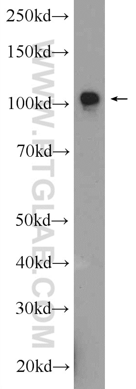 Western Blot (WB) analysis of mouse brain tissue using AP2A2 Polyclonal antibody (15722-1-AP)