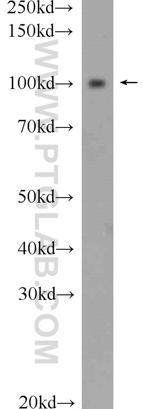 Western Blot (WB) analysis of rat brain tissue using AP2A2 Polyclonal antibody (15722-1-AP)