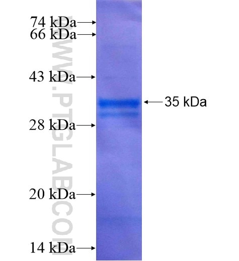 AP2A2 fusion protein Ag8450 SDS-PAGE