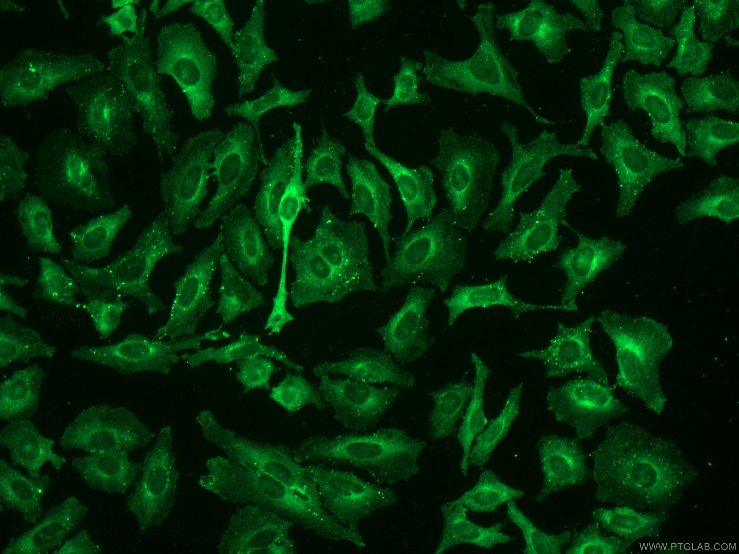 Immunofluorescence (IF) / fluorescent staining of HeLa cells using AP2B1 Polyclonal antibody (15690-1-AP)