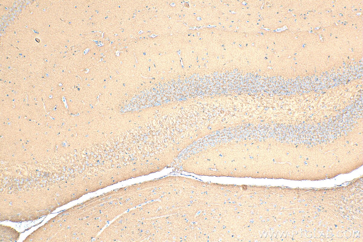 Immunohistochemistry (IHC) staining of mouse brain tissue using AP2B1 Polyclonal antibody (15690-1-AP)