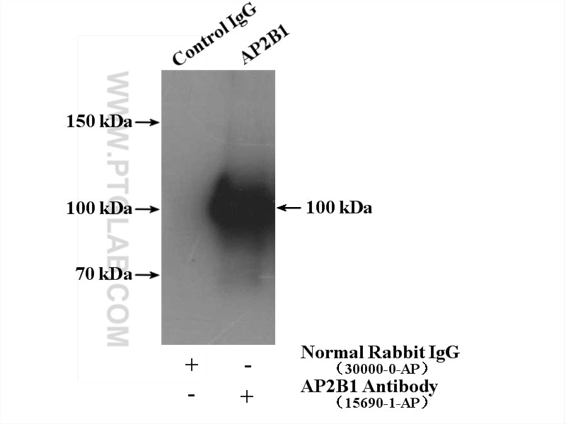 Immunoprecipitation (IP) experiment of K-562 cells using AP2B1 Polyclonal antibody (15690-1-AP)
