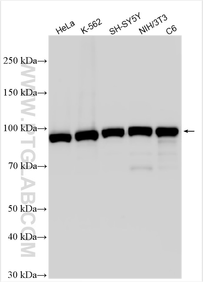 Western Blot (WB) analysis of various lysates using AP2B1 Polyclonal antibody (15690-1-AP)