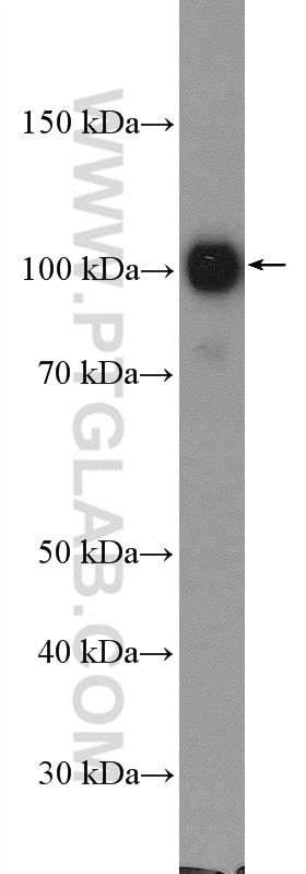 Western Blot (WB) analysis of K-562 cells using AP2B1 Polyclonal antibody (15690-1-AP)