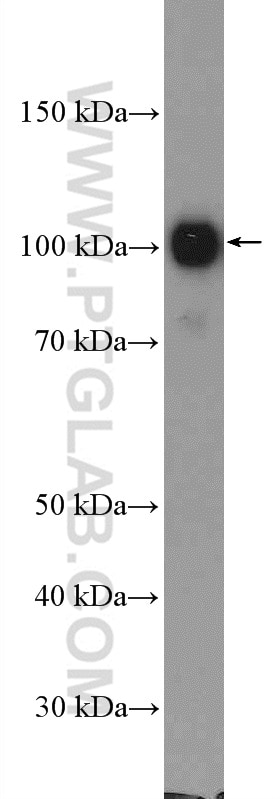 WB analysis of K-562 using 15690-1-AP