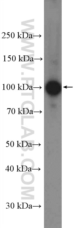 Western Blot (WB) analysis of C6 cells using AP2B1 Polyclonal antibody (15690-1-AP)