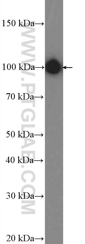 Western Blot (WB) analysis of SH-SY5Y cells using AP2B1 Polyclonal antibody (15690-1-AP)