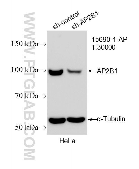Western Blot (WB) analysis of HeLa cells using AP2B1 Polyclonal antibody (15690-1-AP)