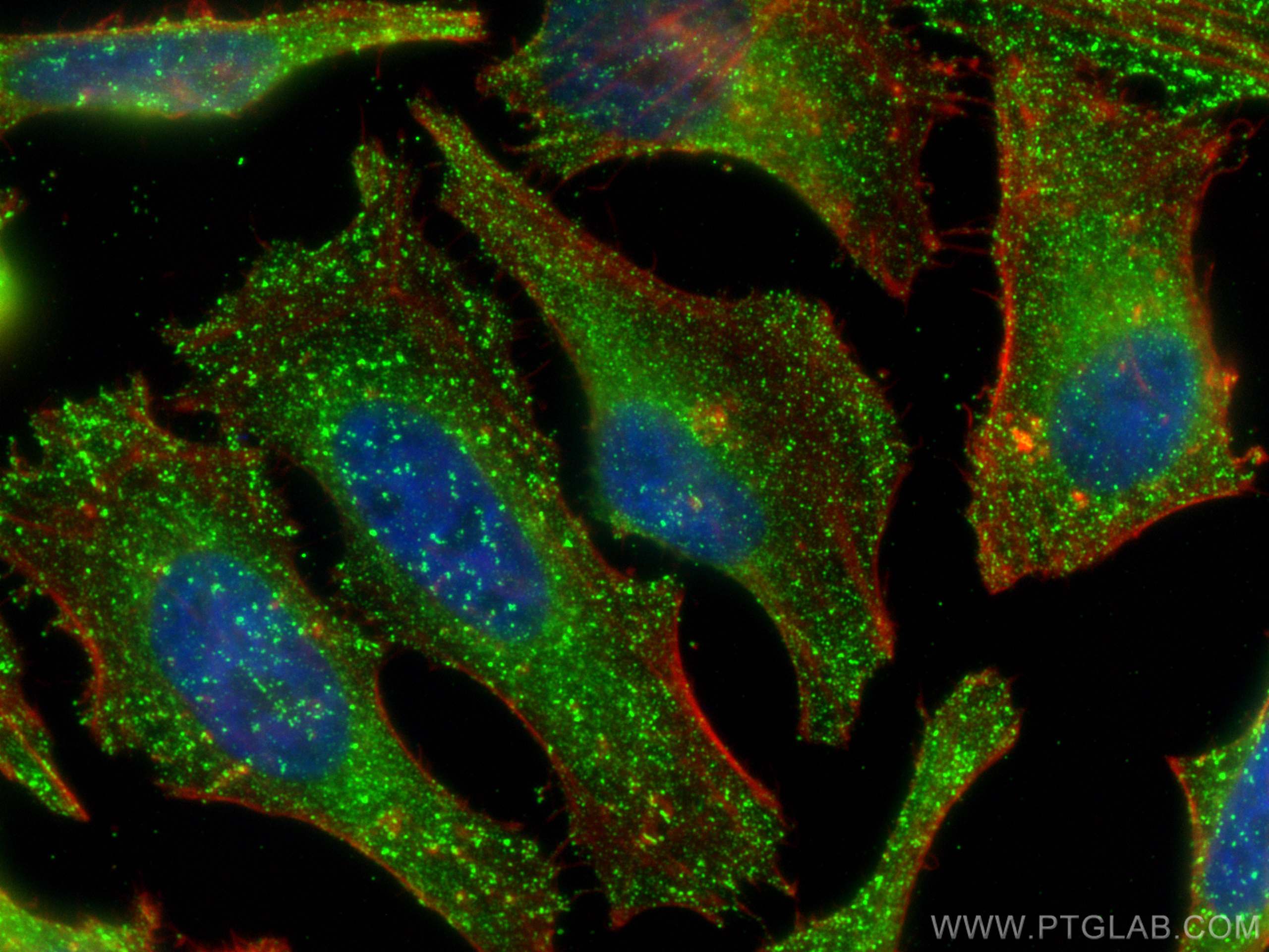 Immunofluorescence (IF) / fluorescent staining of HeLa cells using AP2B1 Monoclonal antibody (68349-1-Ig)