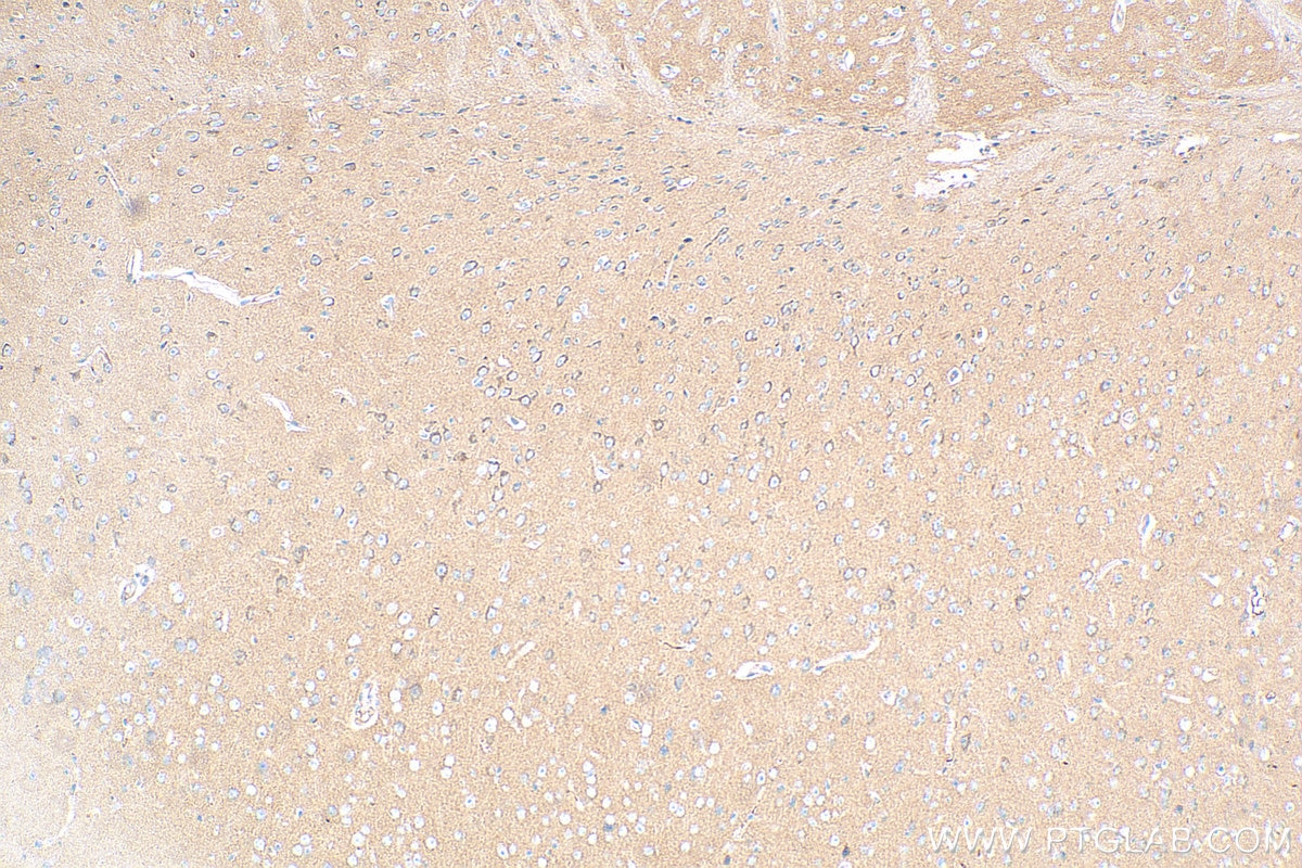 Immunohistochemistry (IHC) staining of rat brain tissue using AP2B1 Monoclonal antibody (68349-1-Ig)