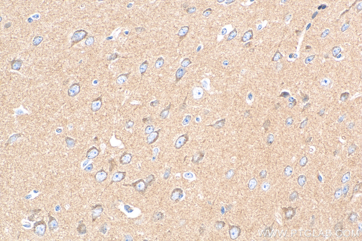Immunohistochemistry (IHC) staining of rat brain tissue using AP2B1 Monoclonal antibody (68349-1-Ig)