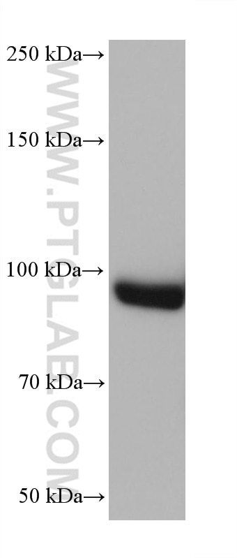 Western Blot (WB) analysis of HeLa cells using AP2B1 Monoclonal antibody (68349-1-Ig)