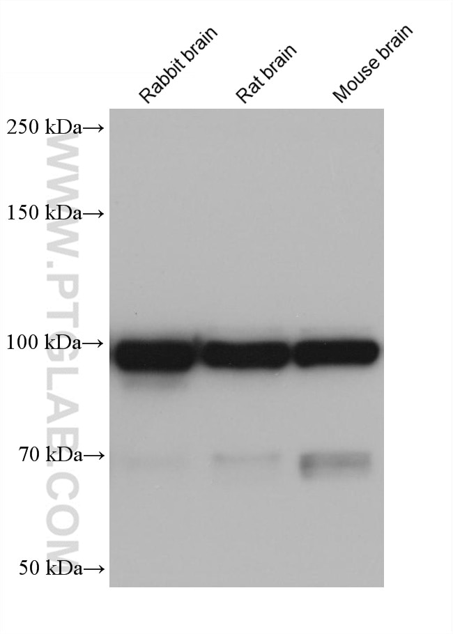 Western Blot (WB) analysis of various lysates using AP2B1 Monoclonal antibody (68349-1-Ig)