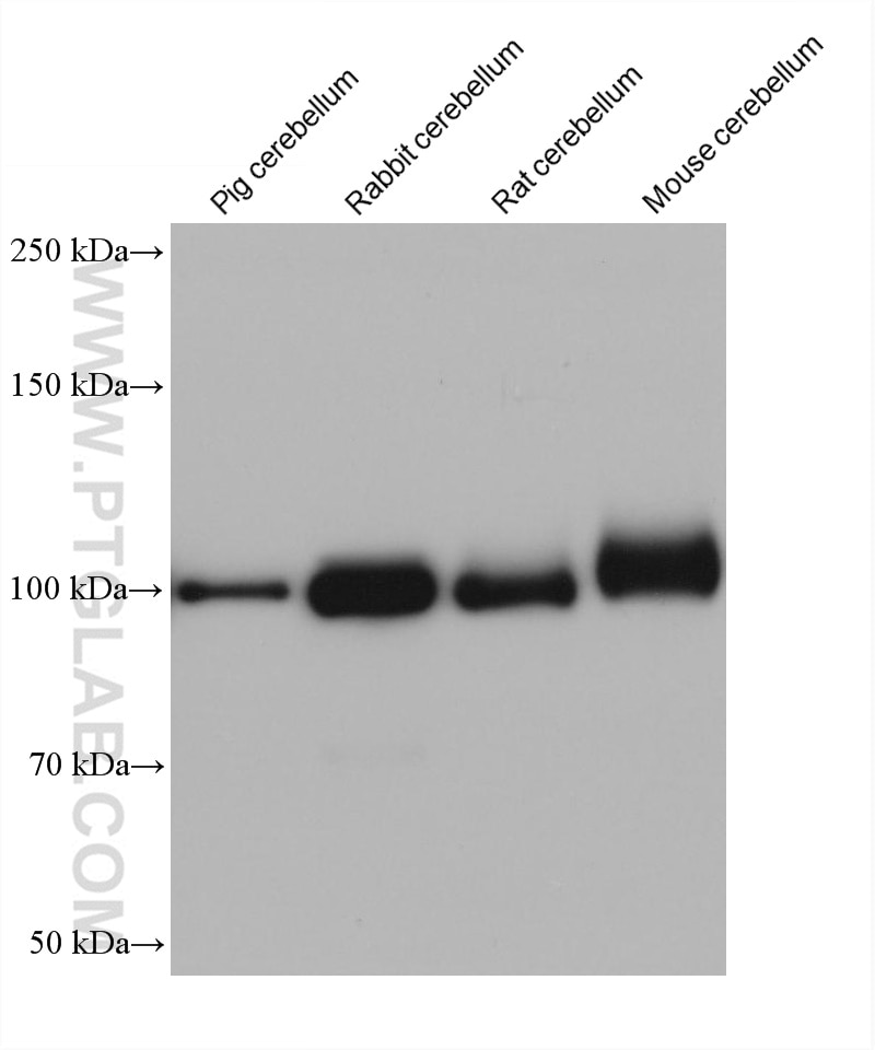 Western Blot (WB) analysis of various lysates using AP2B1 Monoclonal antibody (68349-1-Ig)