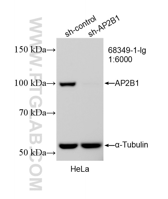 WB analysis of HeLa using 68349-1-Ig Western Blot (WB) analysis of HeLa cells using AP2B1 Monoclonal antibody (68349-1-Ig)