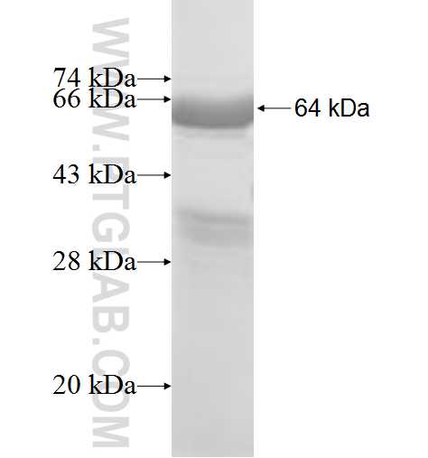 AP2B1 fusion protein Ag8248 SDS-PAGE