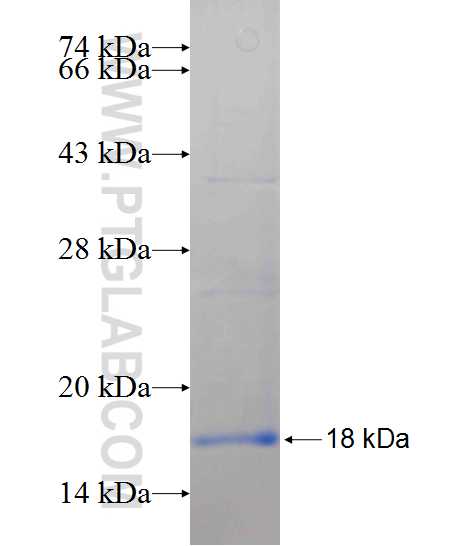 AP2M1 fusion protein Ag25593 SDS-PAGE