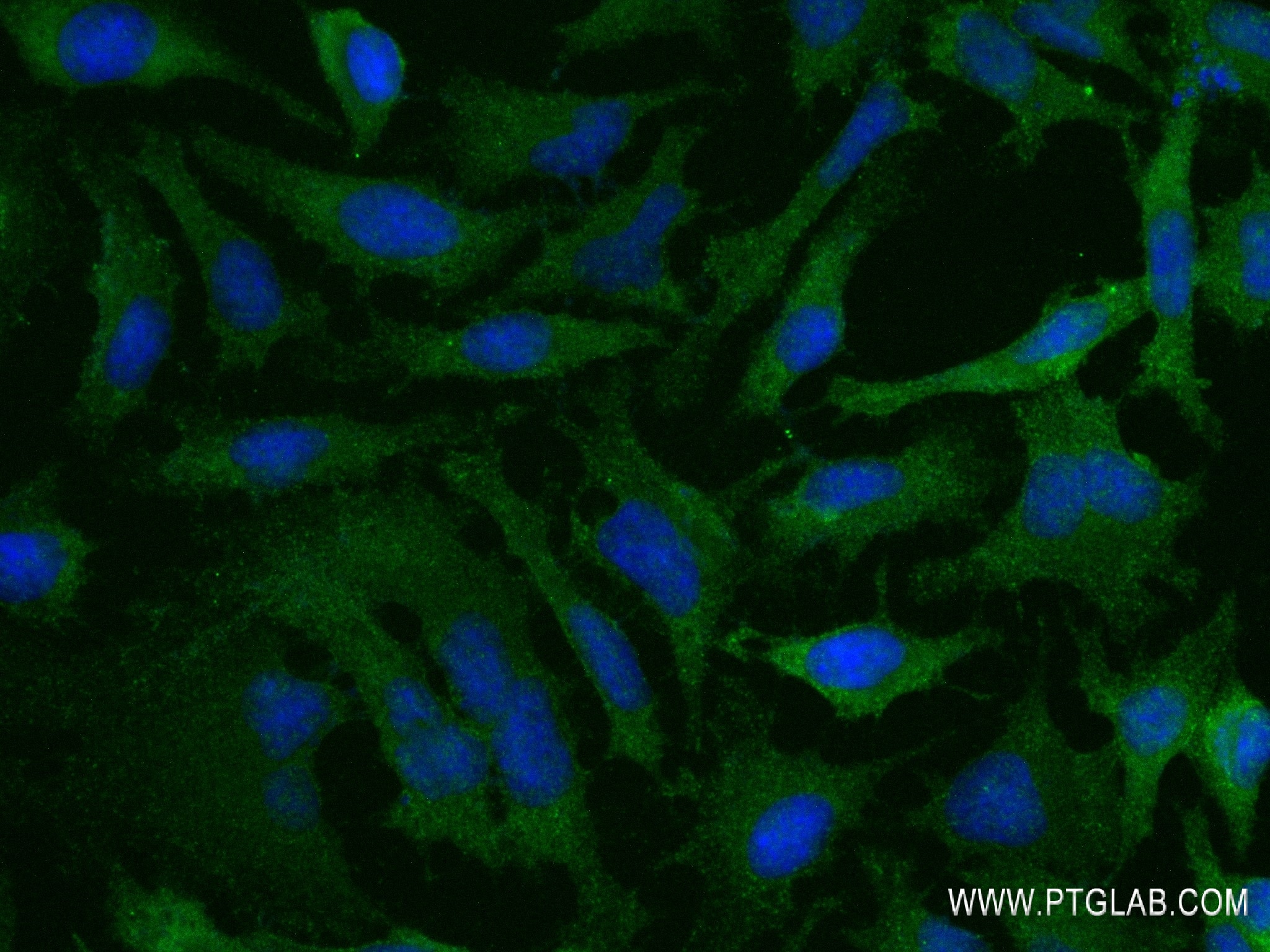 Immunofluorescence (IF) / fluorescent staining of HeLa cells using AP2S1 Recombinant antibody (84174-3-RR)