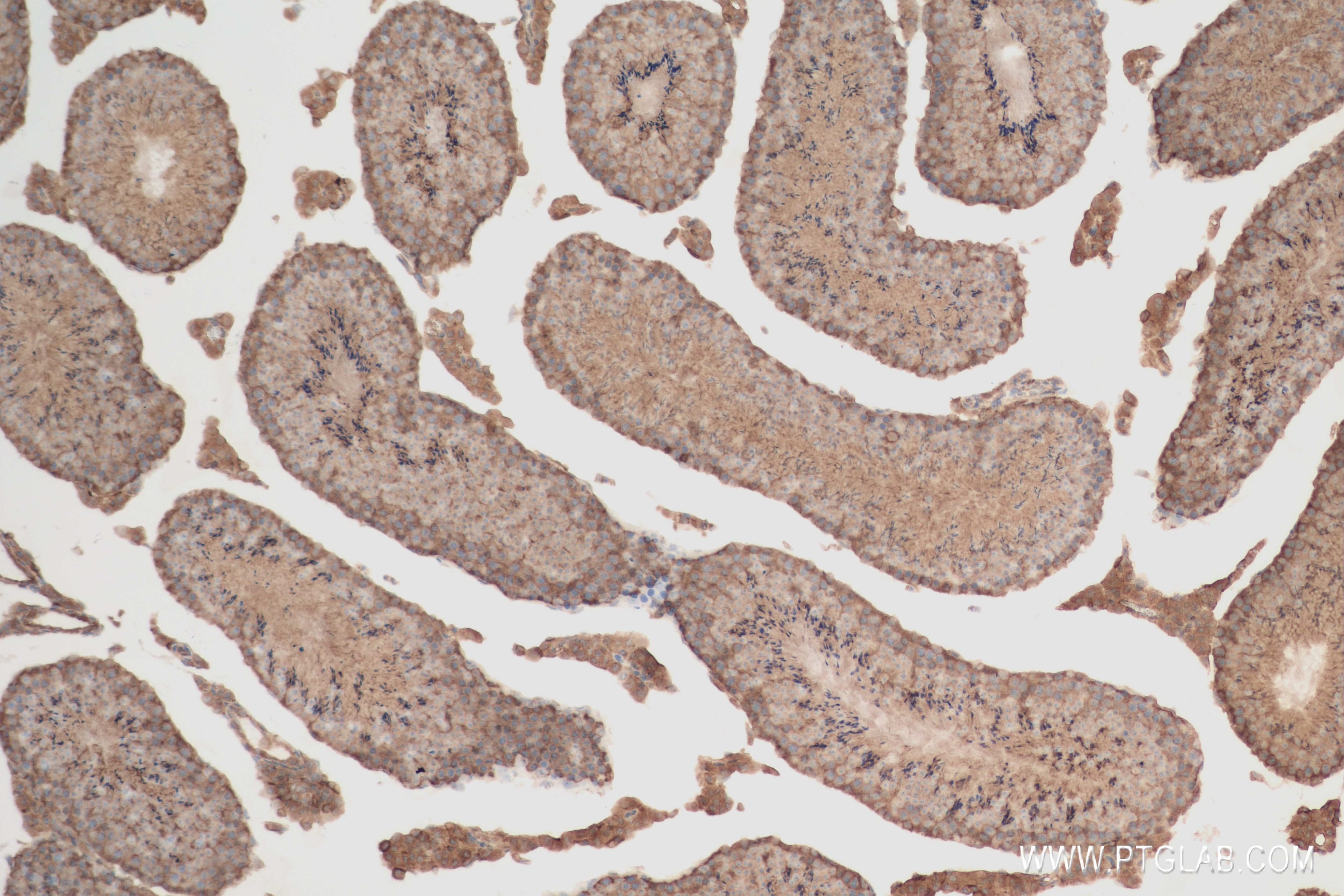 Immunohistochemistry (IHC) staining of mouse testis tissue using AP2S1 Recombinant antibody (84174-3-RR)